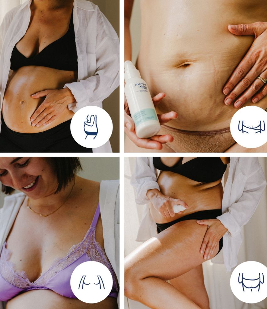 Nourishing Enhancing Anti Stretch Mark Body Oil - doomoo X Shinncare